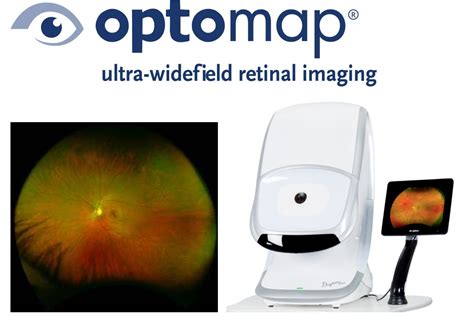 optomap for sale